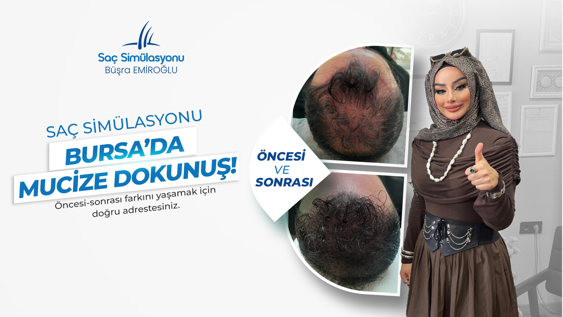 bursa-sac-simulasyon2